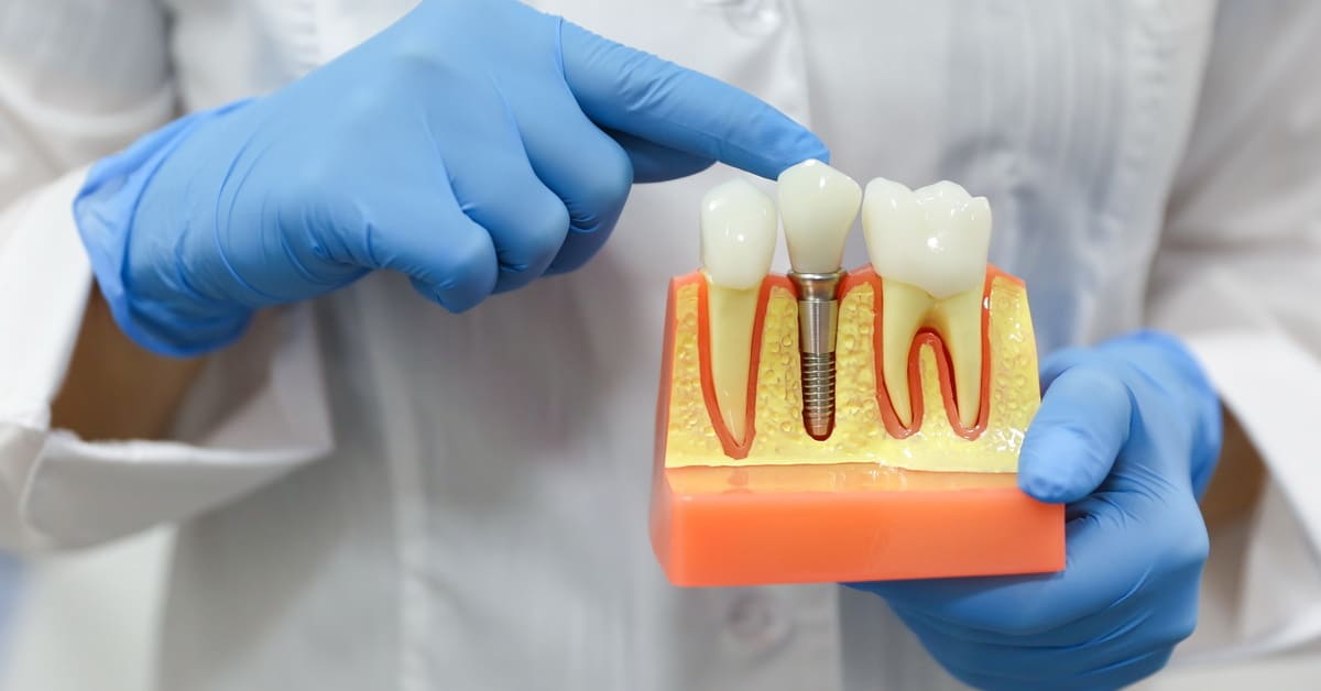 Studio dentostico: come gestire i dispositivi medici