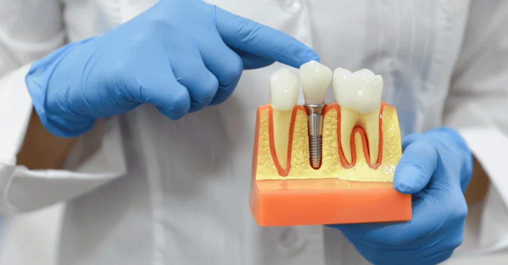 Fondamenti clinici odontoiatrici per chi guida il paziente